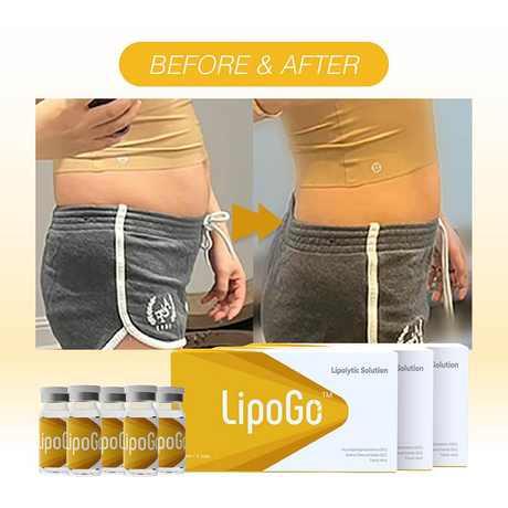 mesolipo injection before and after.jpg