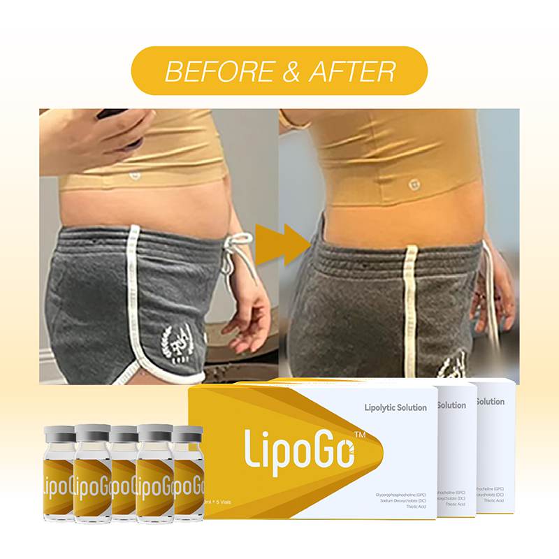 Mesolipo Before & After: Proven Results and Expert Insights