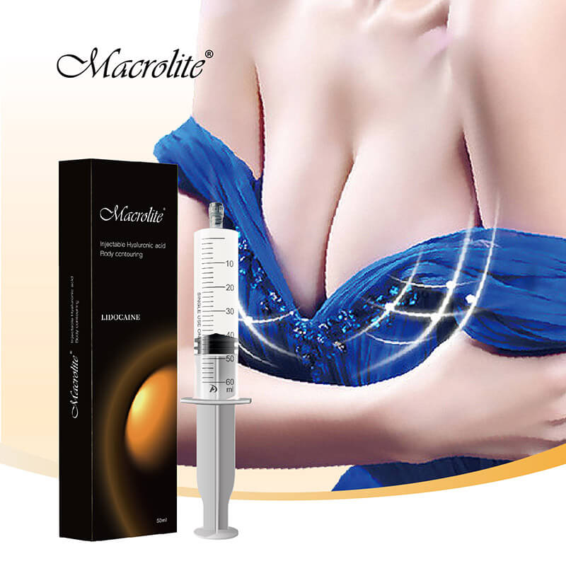 Macrolite Hyaluronic Acid Gel Injections for Breast
