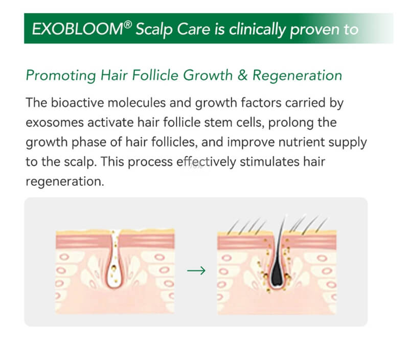 exosomes for hair loss