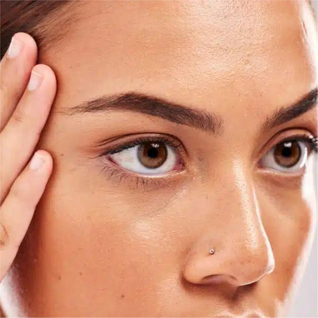  Can botulinum toxin Help Under Eye Bags.jpg