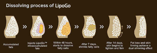 How Do Fat Dissolving Injections Work