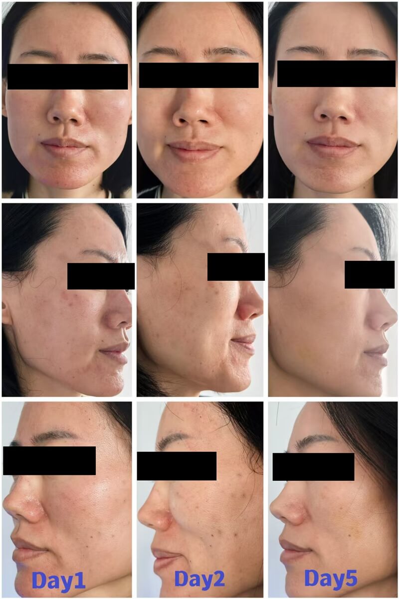 polynucleotides treatment before and after