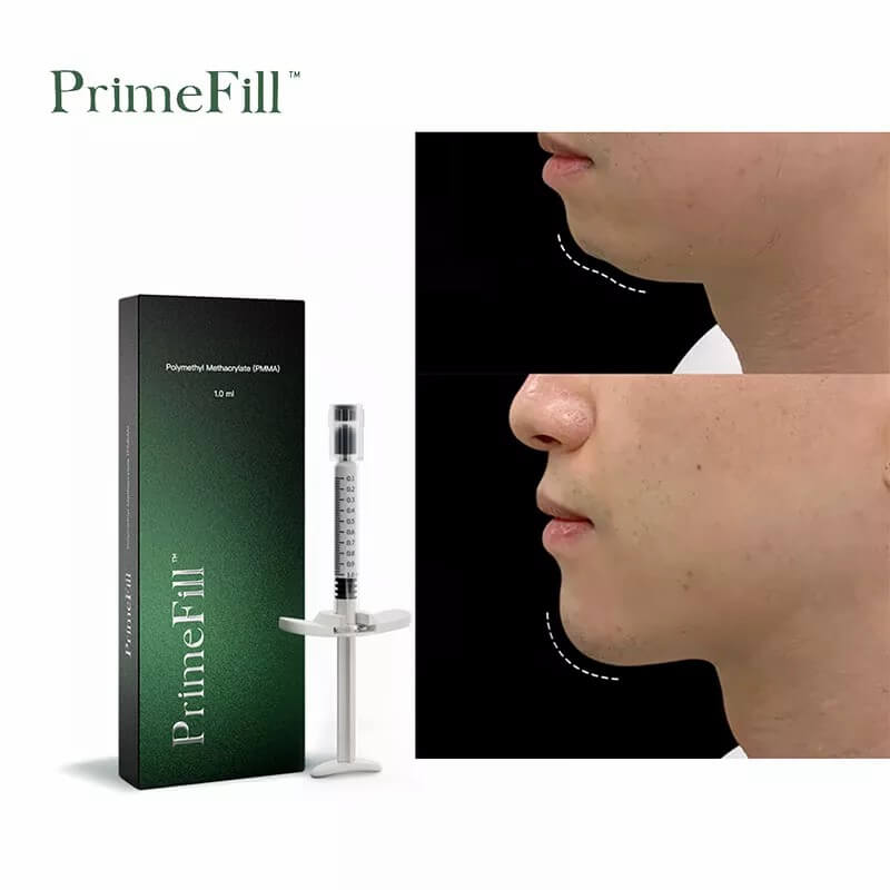 PrimeFill® PMMA Filler Reviews: What Real Users Say