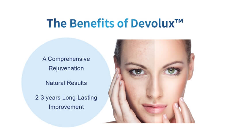 benefits of poly-l-lactic acid collagen stimulator