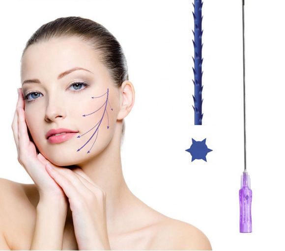 Magik Thread Lifting (2)