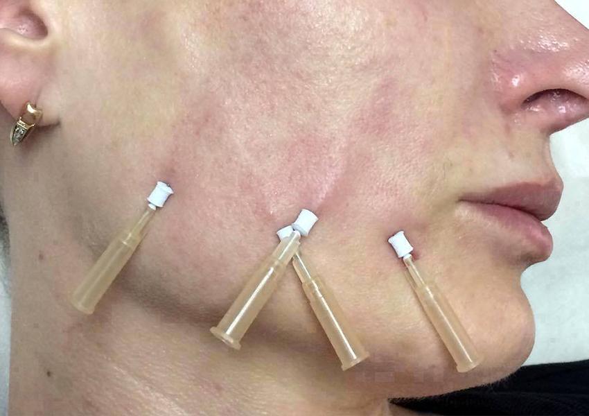 china-pdo-thread-cog