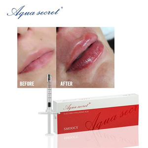 hyaluronic acid lip filler