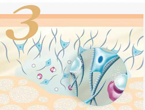 CHArmacy - Calcium Hydroxylapatite Fillers Injections work