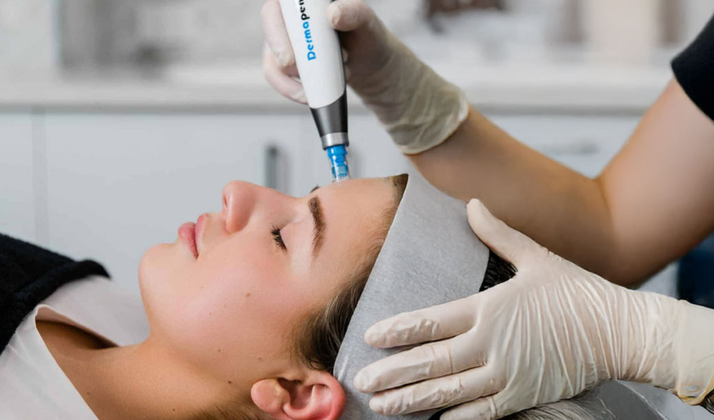 PDRN-microneedling-treatment-in-clinical-setting