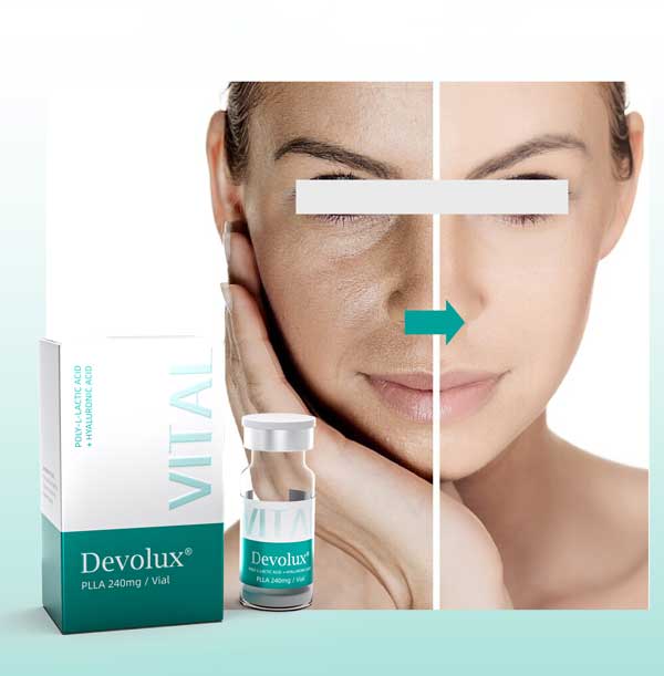 Why PLLA Filler Results Are Gradual And When To Expect Results?