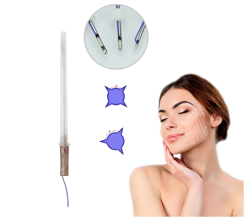 25.4mm Screw Pdo Thread