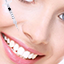 Nasolabial Folds
