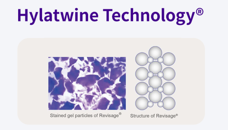 Juvensence Smoocy 1 ml syringe lip filler technology