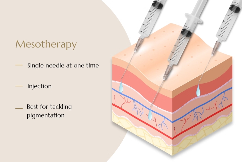 What is Mesotherapy
