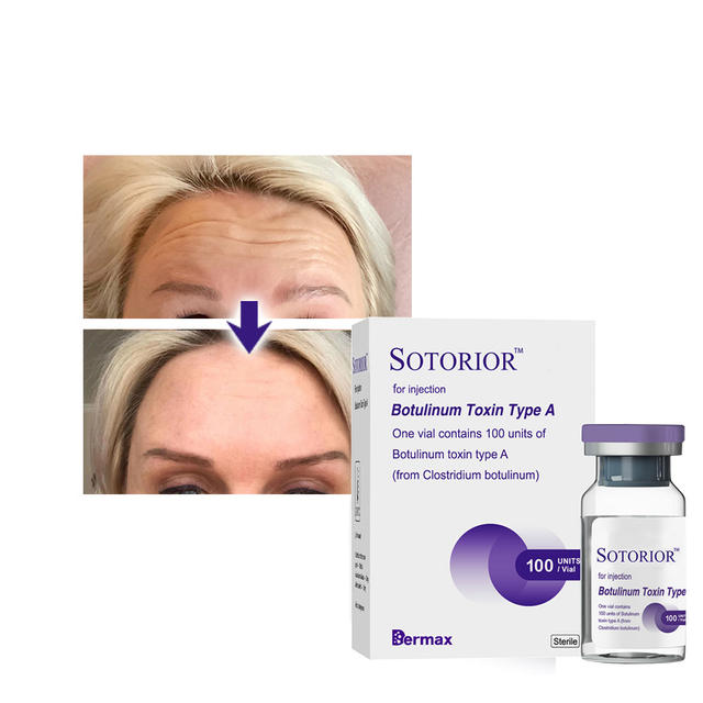 What's The Difference Between Botulinum Toxin And Fillers