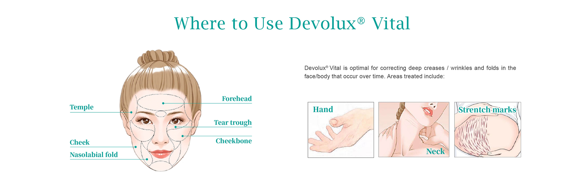 plla collagen stimulator