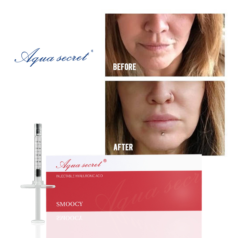 Lip Injection Sale: Aqua Secret Smoocy