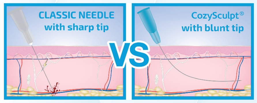 cannula vs needle for lip filler