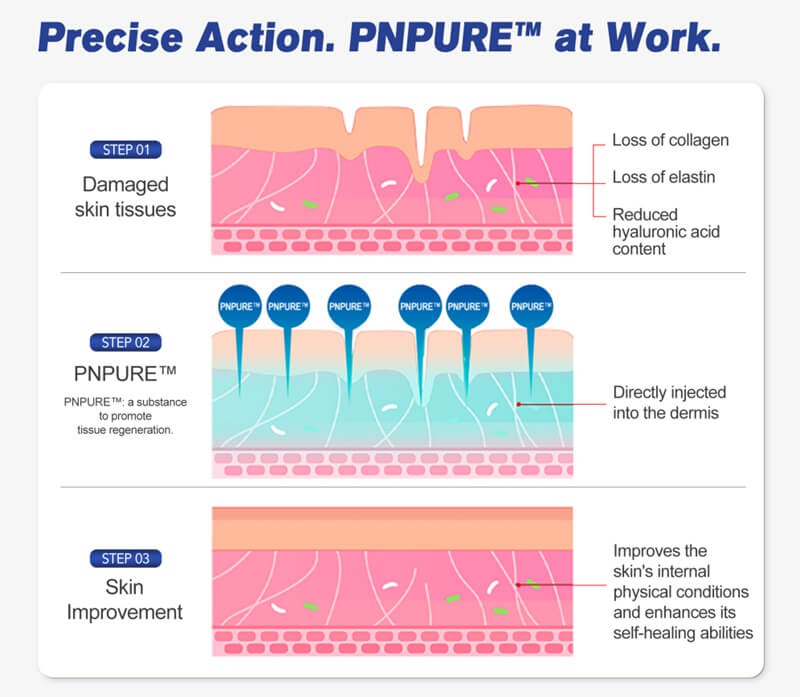 how polynucleotide fillers work