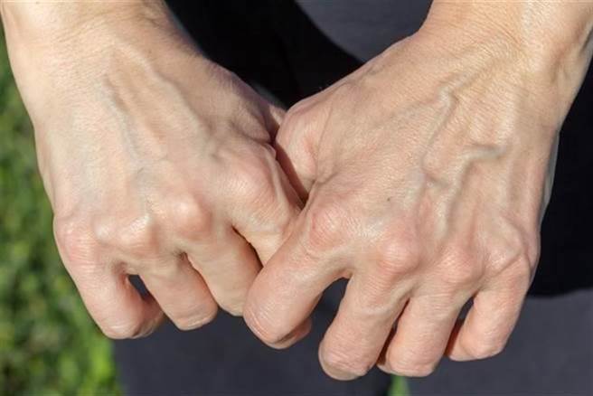 Aging hands
