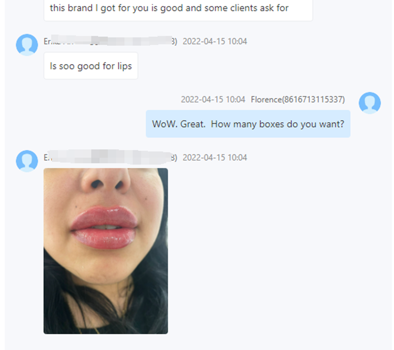 2ml lip filler before and after natural result