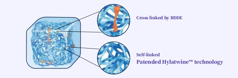 Hyaluronic acid filler for breast (5)