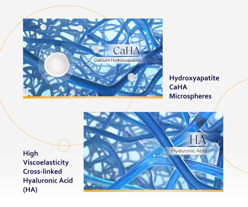 calcium hydroxylapatite filler vs hyaluronic acid