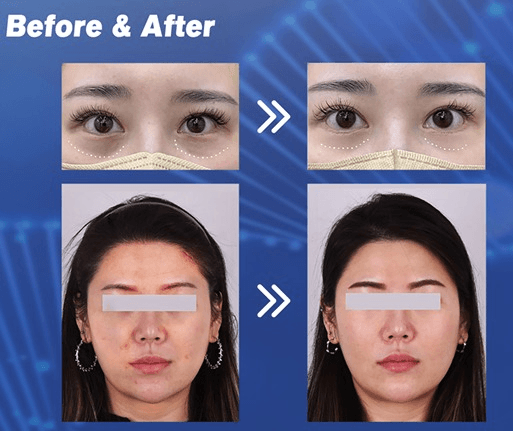 Before and After: Real Visual Progression
