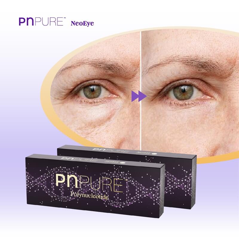 Polynucleotides Under Eyes Before and After: Real Results