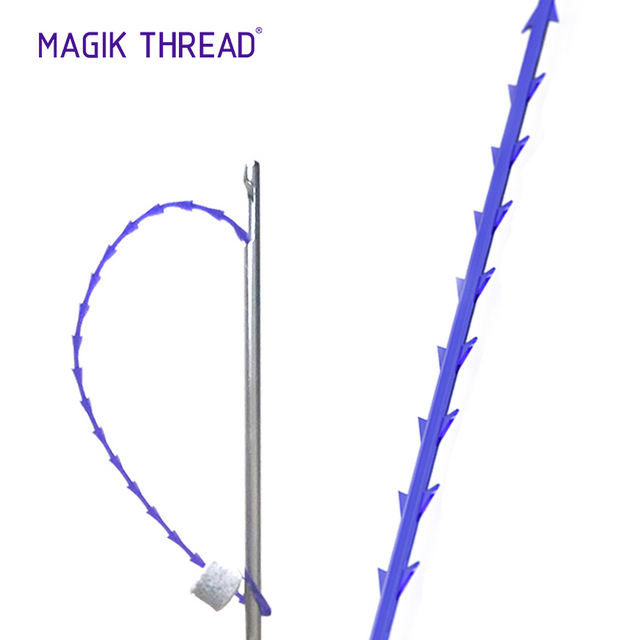 Molding Cog Thread