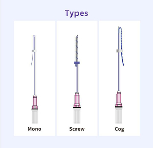 Molding Cog 19G Online for Sale 