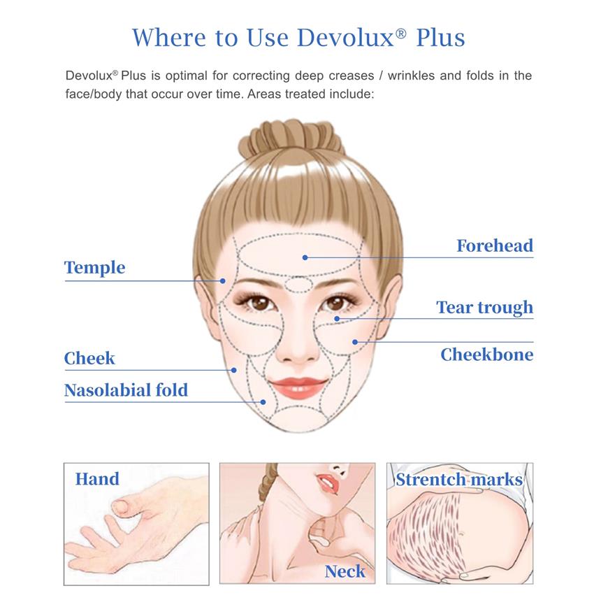 plla filler buttock injections