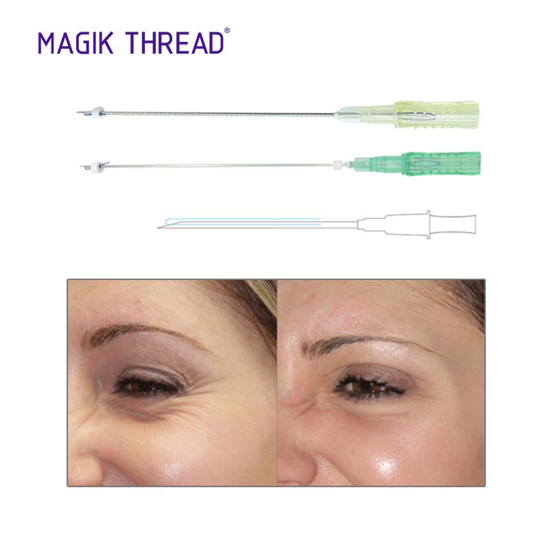 PDO Mono Thread Lifts: Exploring Magik Thread