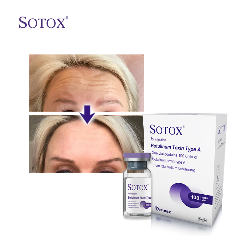 Botulinum Toxin Brow Lift Price: How Much Is a Brow Lift Botulinum Toxin