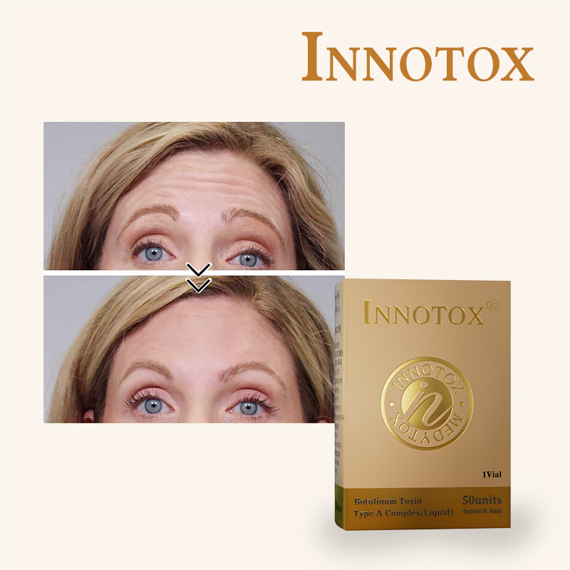 Innotox Before And After: Real User Reviews