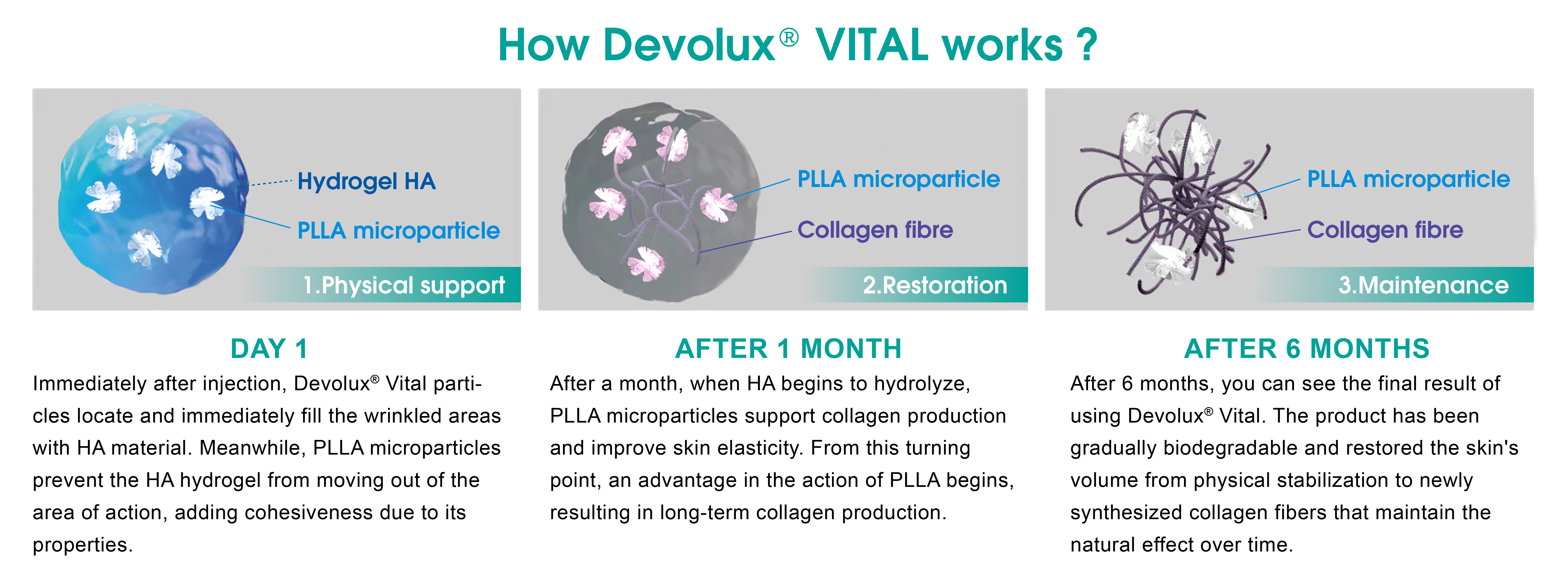 how does Korean Poly-l-lactic Acid Dermal Filler work
