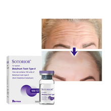 Pure-Sotorior-Botulinum-Toxin-