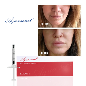 2ml Lip Filler:Achieve The Perfect Pout