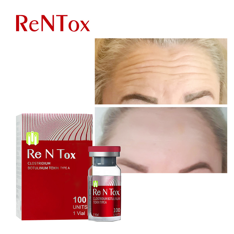 Botulinum Toxin Ren Tox 100 units