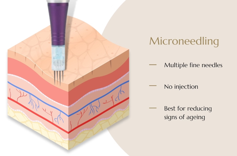 What Is Microneedling