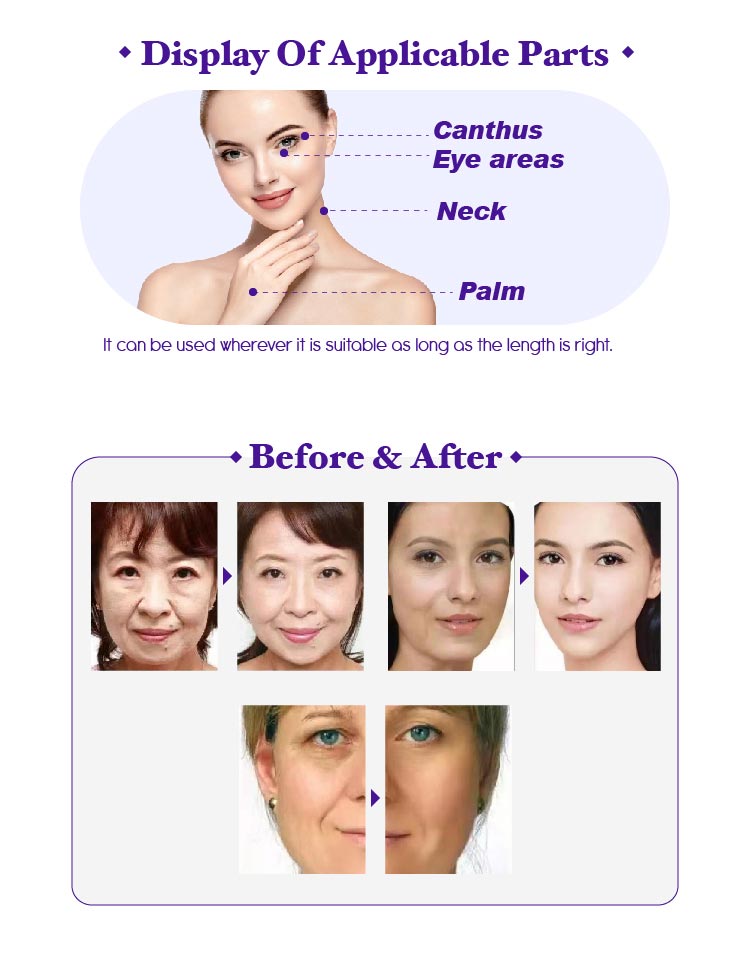 where to buy pdo threads