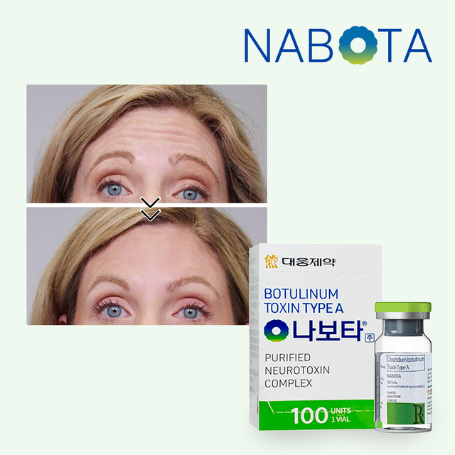 Korea Nabota Botulinum Toxin Type A Buy Online