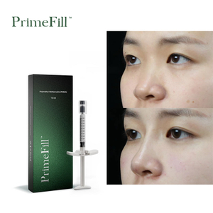 PrimeFill Pmma filler Injection Wholesaler