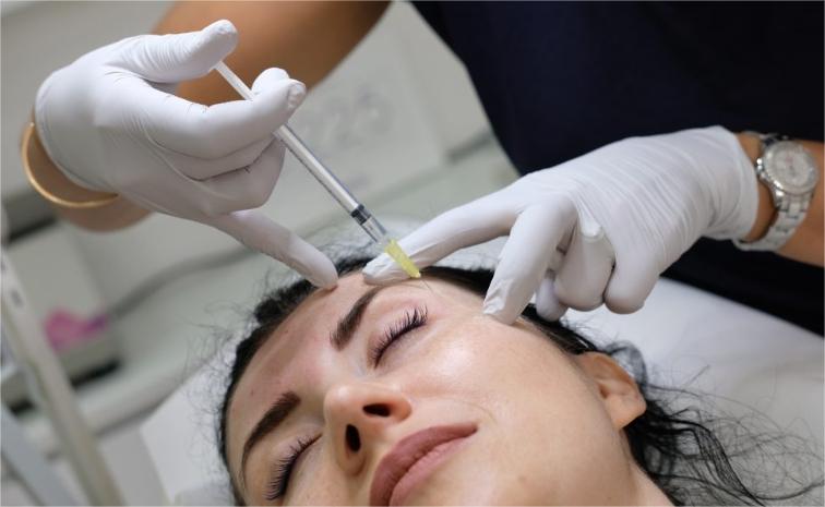 dermal Fillers for Crow's Feet (2)(1)