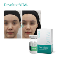 //ikrorwxhijpllq5p.ldycdn.com/cloud/mqBprKjkRllSjkjimolii/plla-injection-thickens-facial-ligaments.jpg