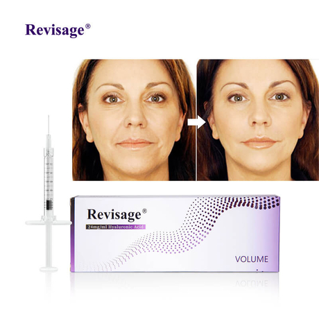 danger zones in facial injections.jpg