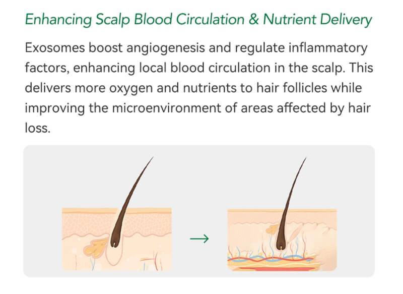 exosomes for hair loss