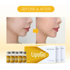 Face Fat Dissolving Injections