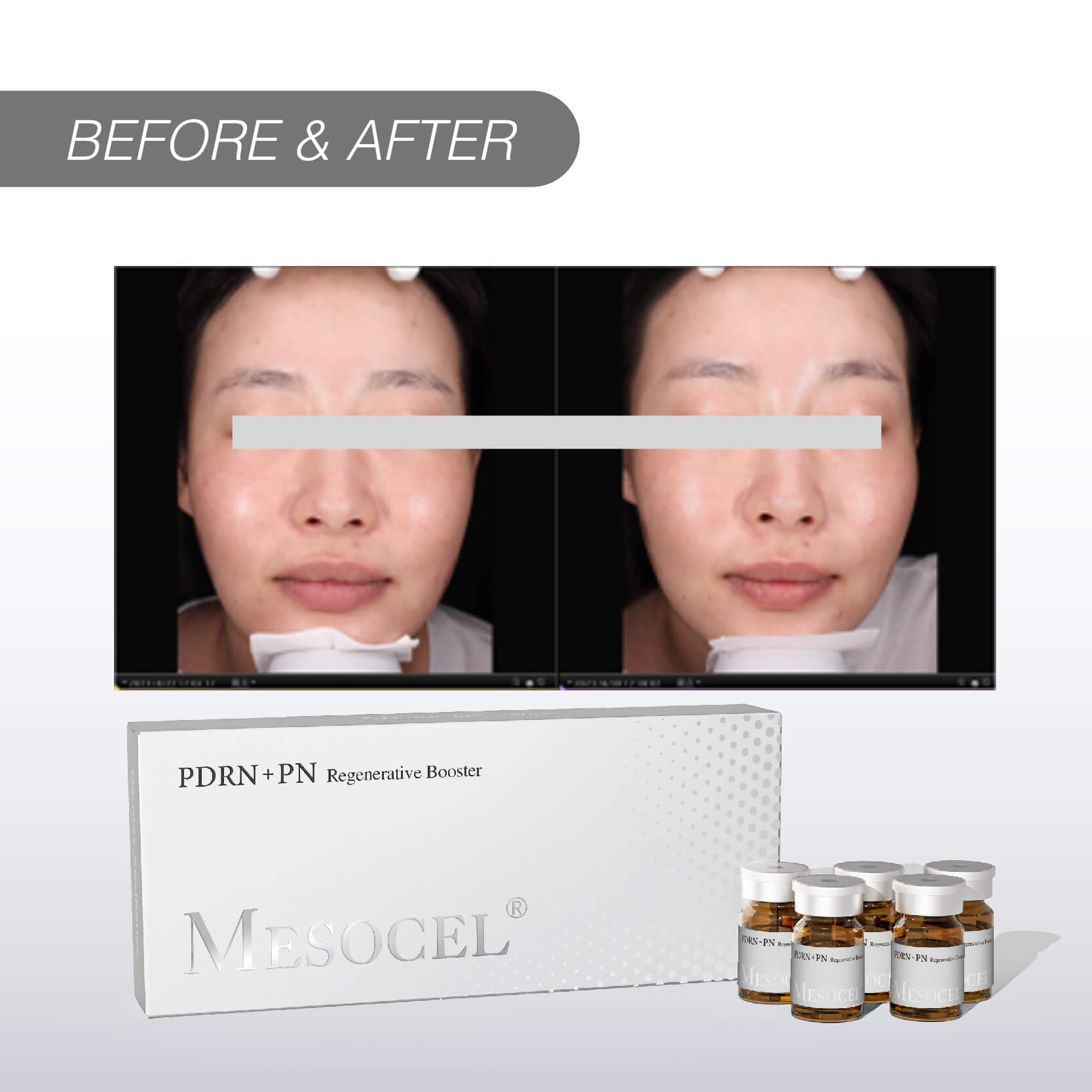 Mesocel&reg; PDRN+PN Regenetive Booster